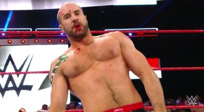 Cesaro picked up a deceptively gruesome mouth injury after breaking his front teeth