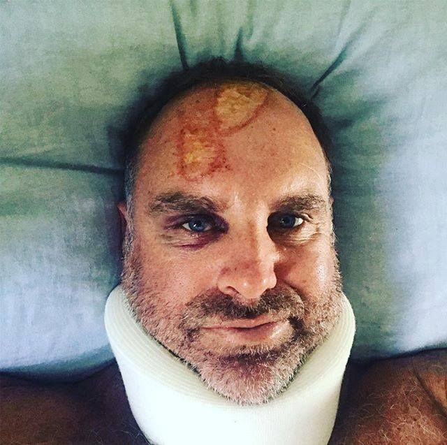 Mathew Hayden injured his head while surfing