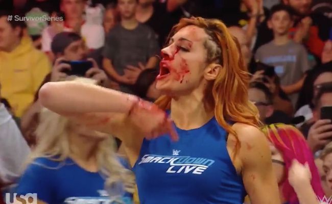 Becky Lynch stood tall despite having a concussion