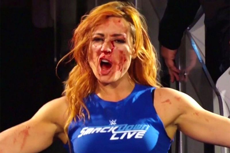 Becky Lynch