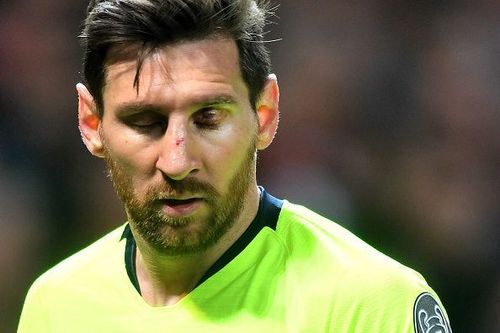 Messi was left bleeding from the eyelid and the nose due to an elbow from United's Smallin