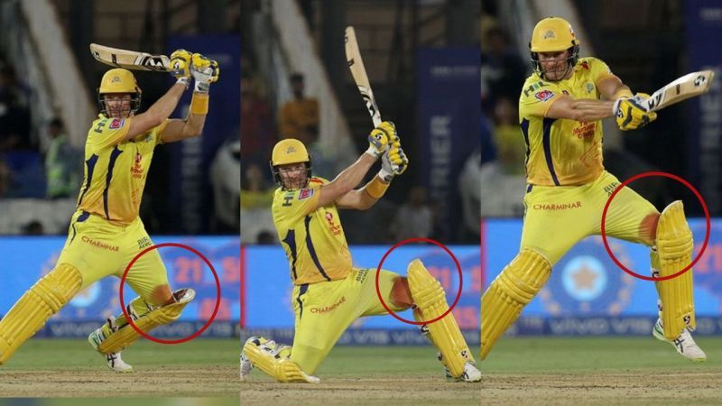 Shane Watson scored a half-century despite a bleeding knee ( Pic credits: IPLT20)