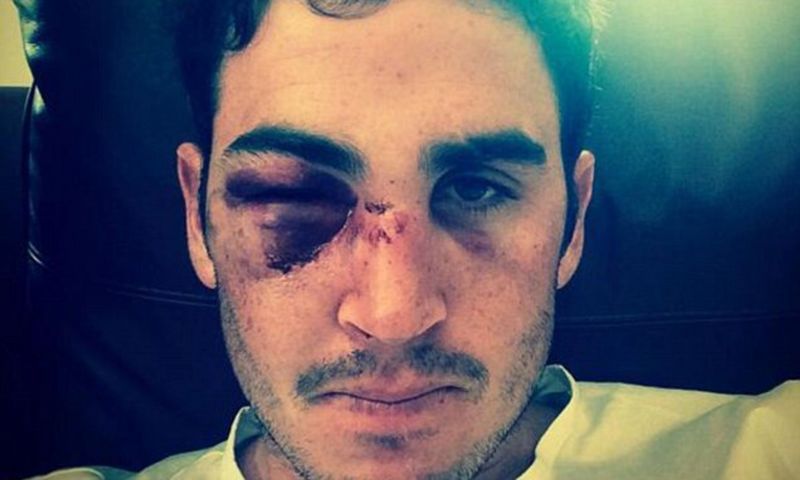 Craig Kieswetter sustained a major injury that forced him to retire from the game.