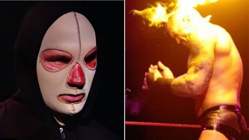 Randy Orton is now wearing a mask after suffering burns from Alexa Bliss' fireball attack