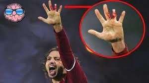 Paulo Diogo lost half his finger in an injury that could have been avoided.