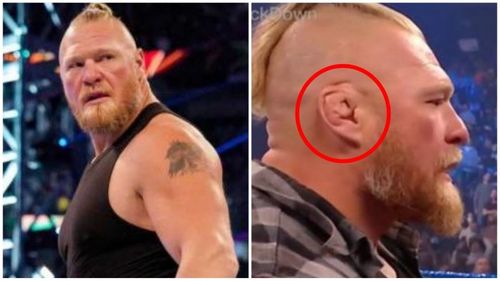 Brock Lesnar's right ear has always looked 'different'