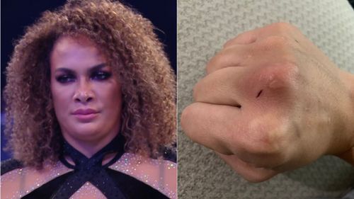 Nia Jax (left); Jax's fist after she punched Becky Lynch (right)