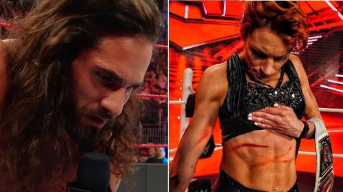 After Becky Lynch showed off scars from Bianca Belair's attack, Seth Rollins reacts.