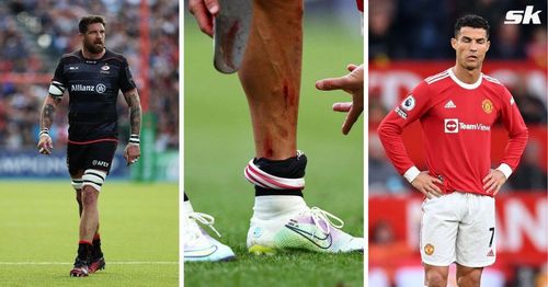 Jim Hamilton plays down Cristiano Ronaldo's shin injury by comparing it to Rugby star's accident