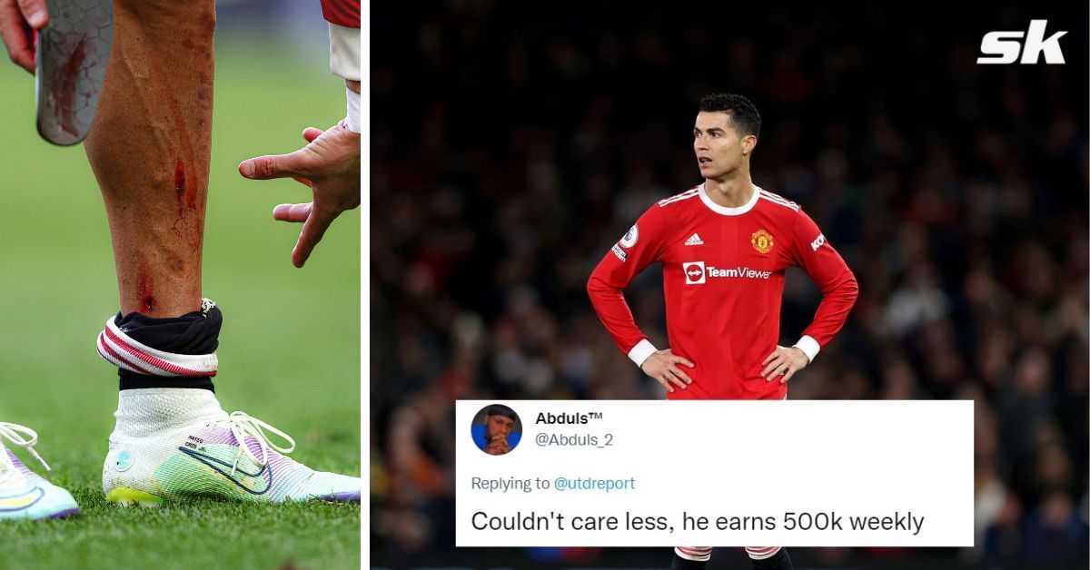 United fans show no sympathy towards Ronaldo as picture of bruised leg surfaces
