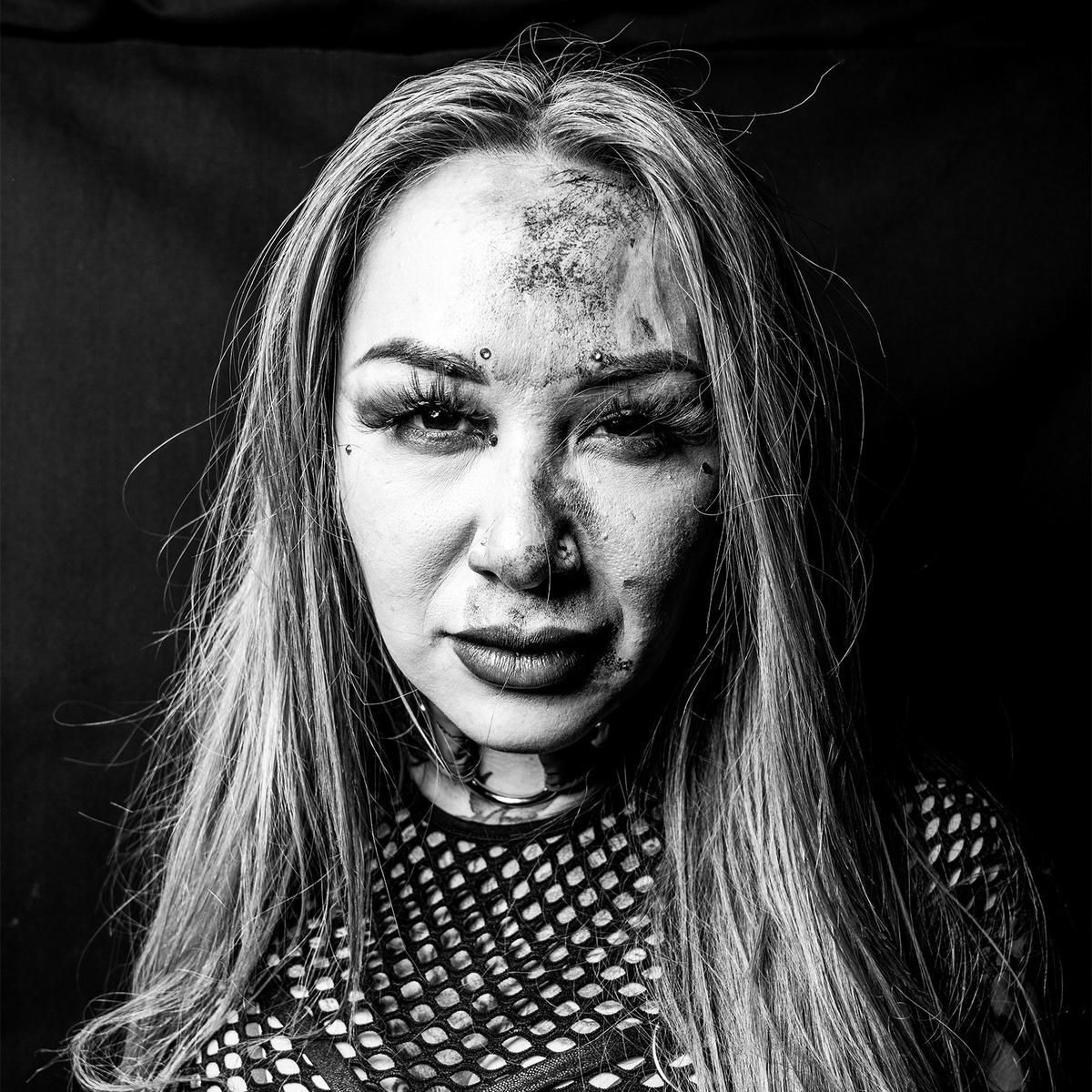 Shotzi Blackheart showing off her injury after the match!