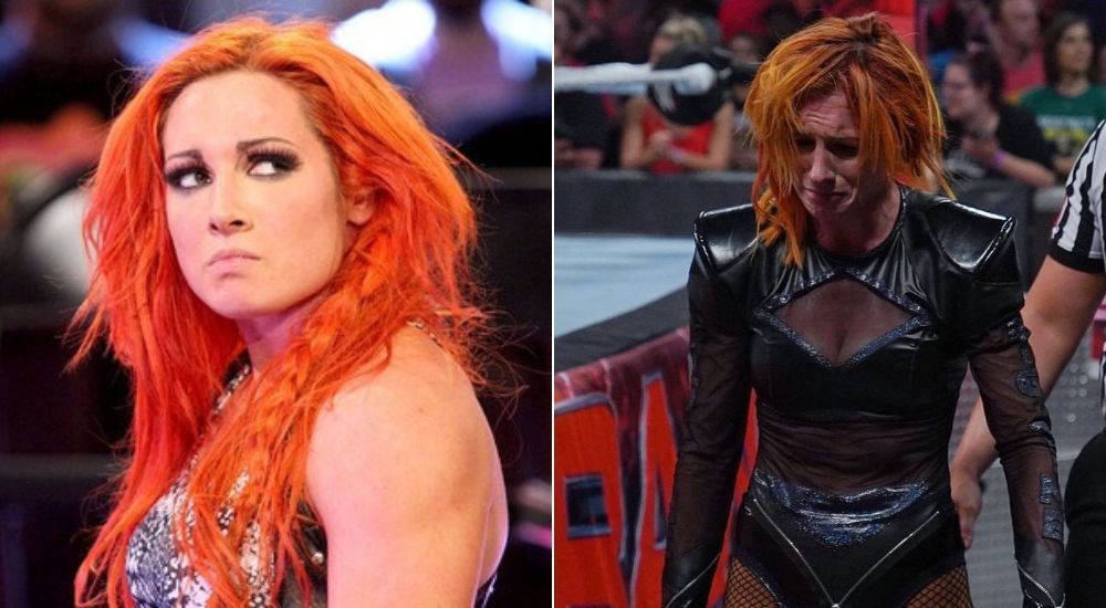 Former WWE RAW Women&#039;s Champion Becky Lynch