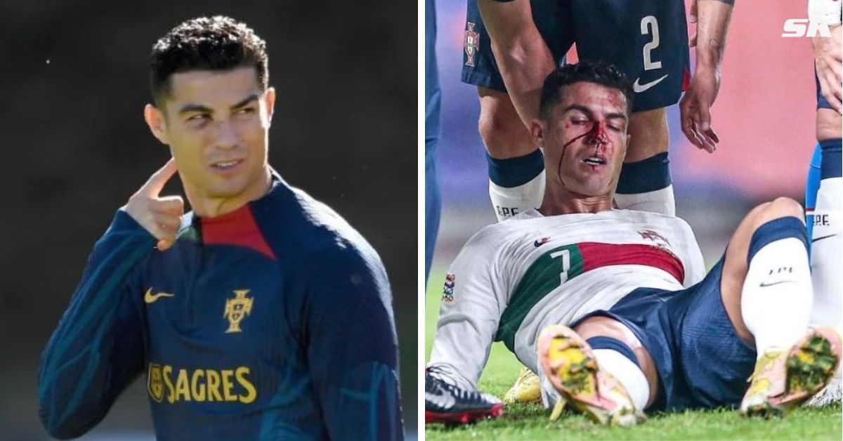 Ronaldo nurses injury from win over the Czechs