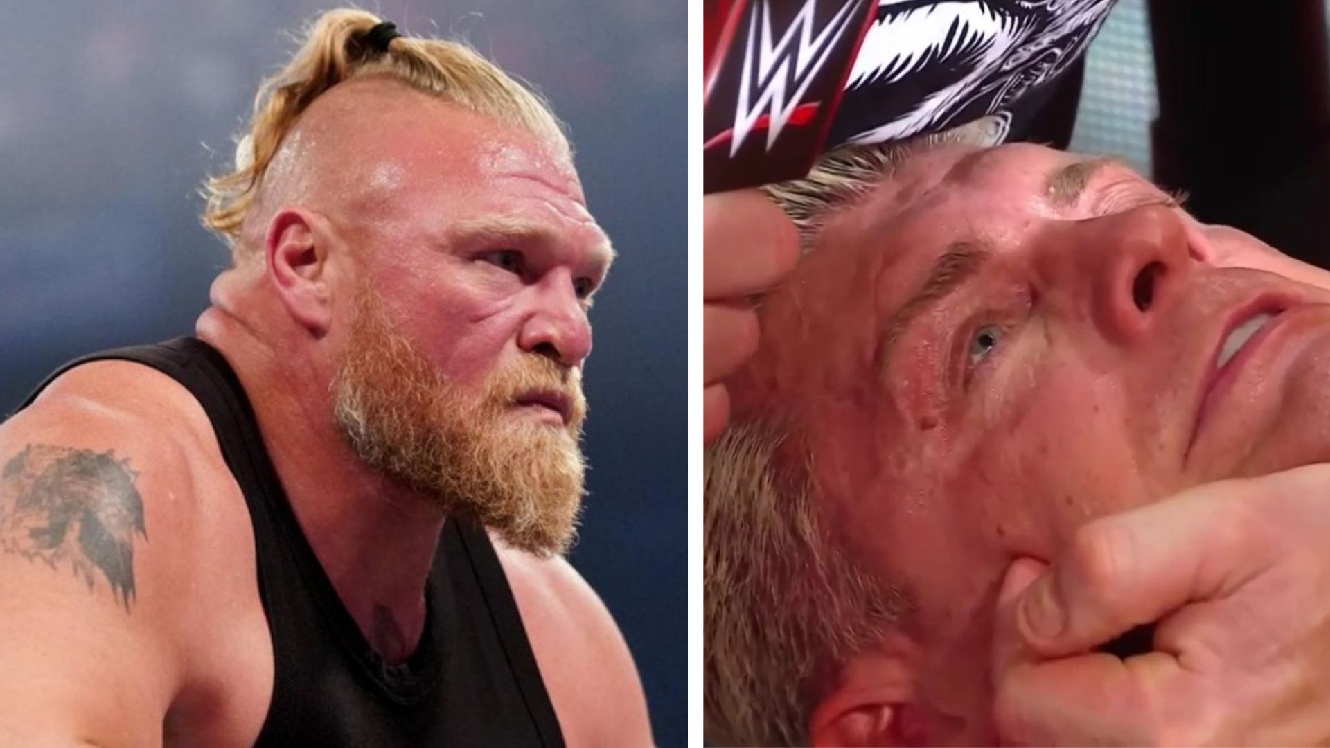 Brock Lesnar got busted open during his WWE Backlash showdown