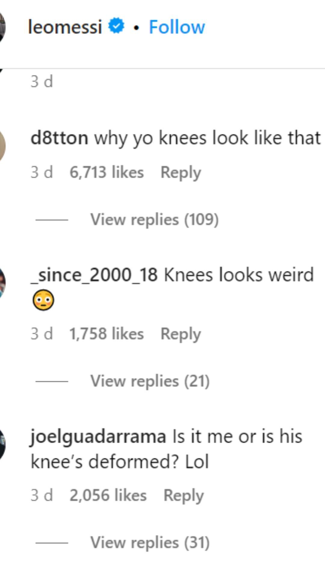 Fans are stunned by Messi&#039;s knees