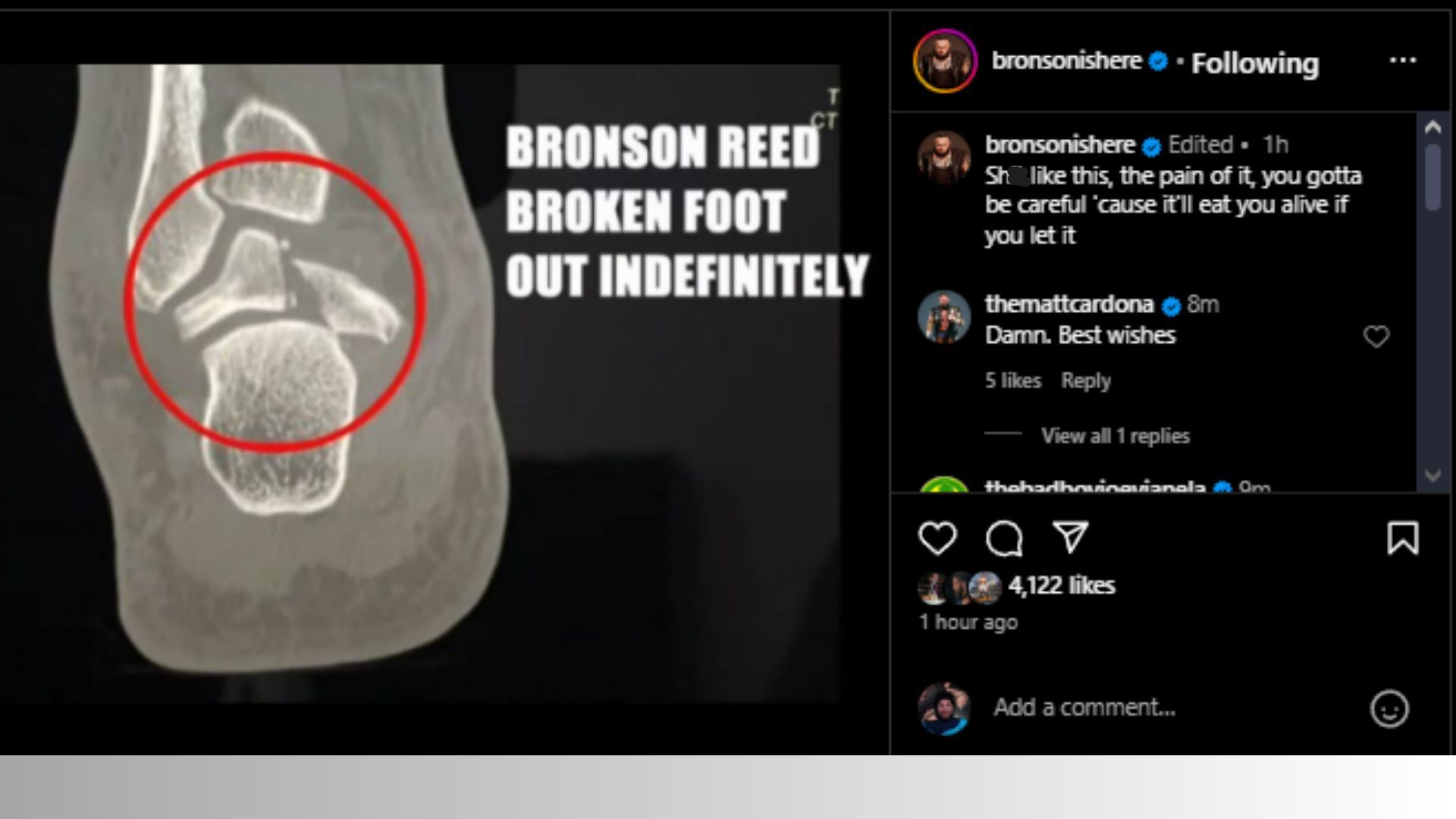 Bronson Reed has posted about it (Credit: Bronson&#039;s Instagram)