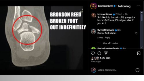 Bronson Reed has posted about it (Credit: Bronson's Instagram)