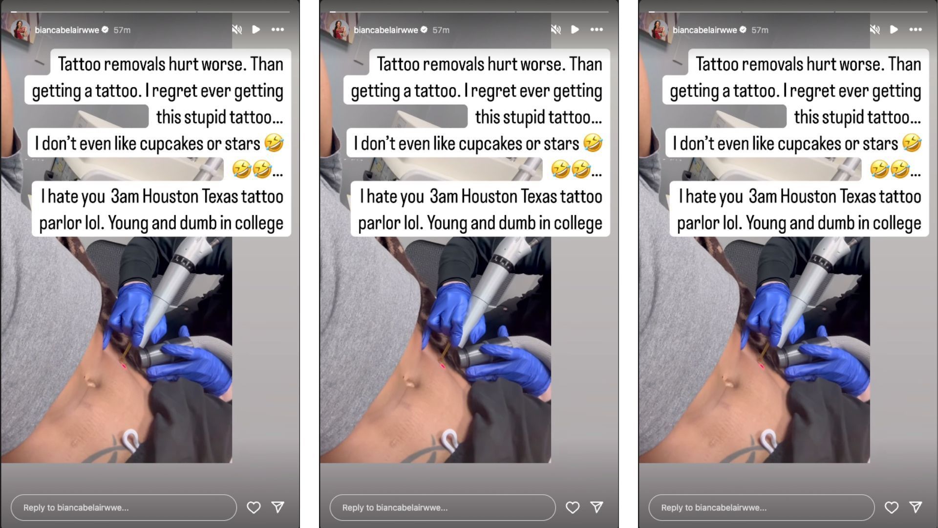 Belair had one of her tattoos removed today. [Image credit: Screengrab of Bianca Belair&#039;s Instagram story]