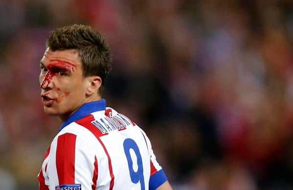 Mario Mandzukic